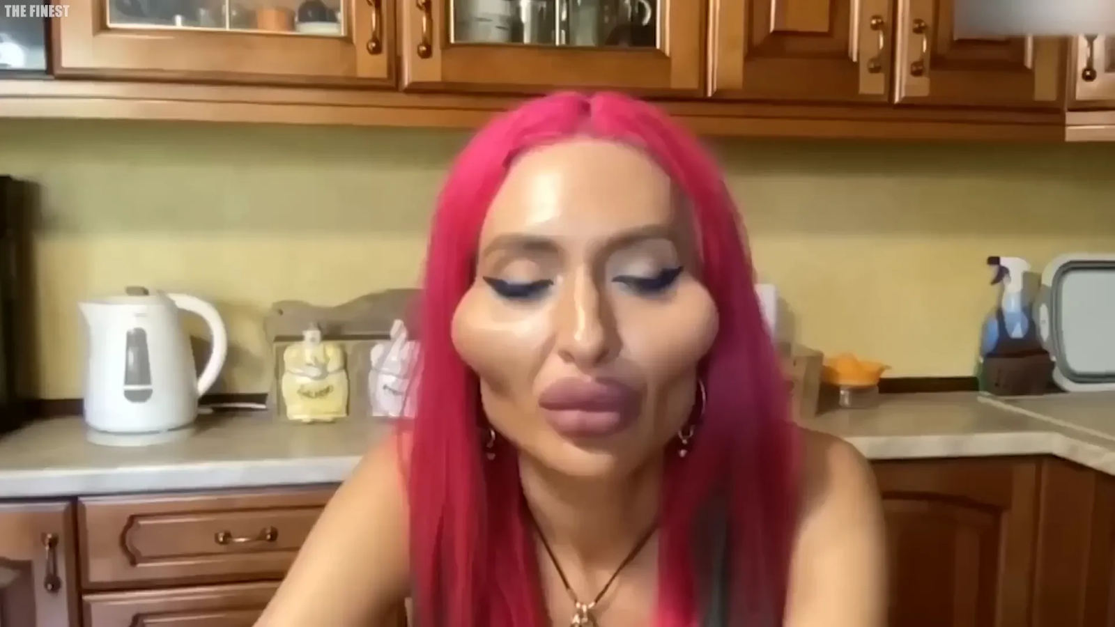 אנסטסיה פולישצ'וק לפני ואחרי הניתוחים