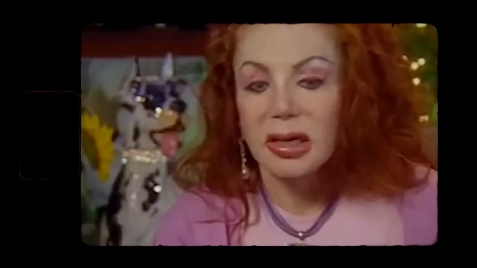 ג'קי סטלון לפני ואחרי הניתוחים